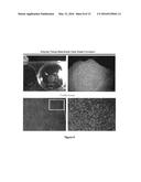 USE OF MESOTHELIAL CELLS IN TISSUE BIOENGINEERING AND ARTIFICIAL TISSUES diagram and image