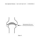 USE OF MESOTHELIAL CELLS IN TISSUE BIOENGINEERING AND ARTIFICIAL TISSUES diagram and image