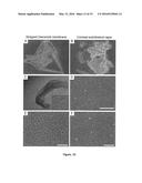 USE OF MESOTHELIAL CELLS IN TISSUE BIOENGINEERING AND ARTIFICIAL TISSUES diagram and image