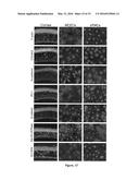 USE OF MESOTHELIAL CELLS IN TISSUE BIOENGINEERING AND ARTIFICIAL TISSUES diagram and image