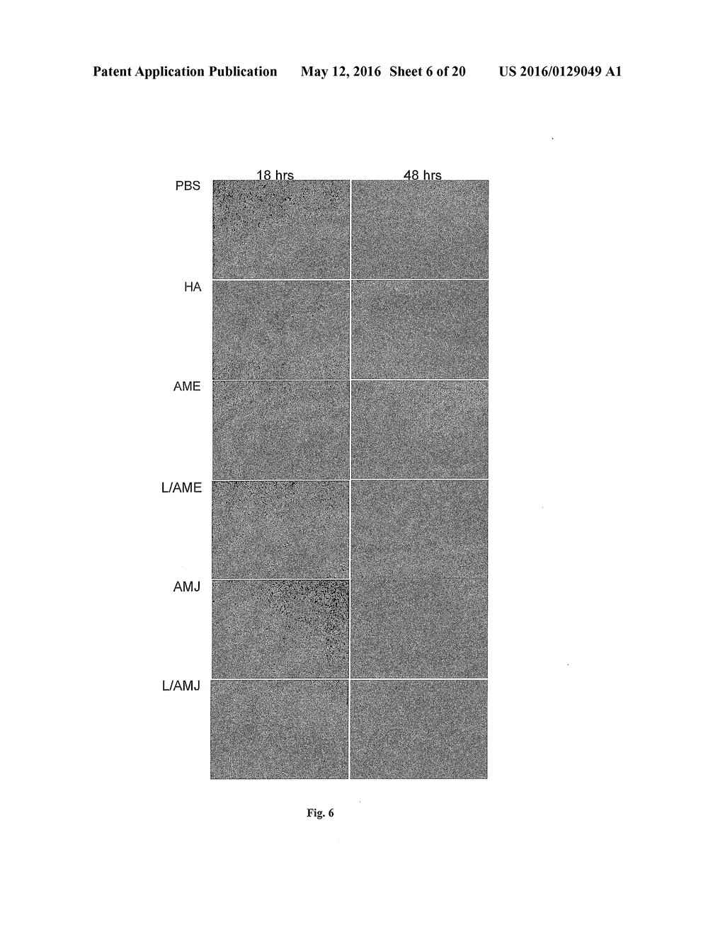 PURIFIED AMNIOTIC MEMBRANE COMPOSITIONS AND METHODS OF USE - diagram, schematic, and image 07