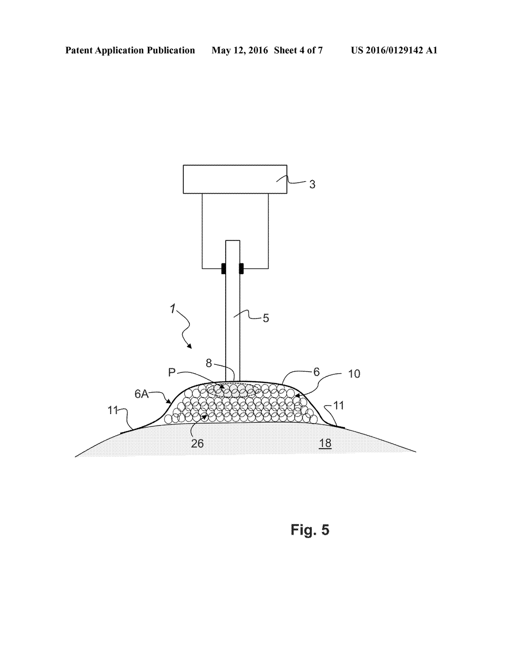 SYSTEM AND METHOD FOR REDUCING GERMS BY MEANS OF PLASMA - diagram, schematic, and image 05