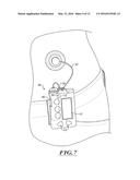 WIRELESS STRAIN GAUGE/FLOW SENSOR diagram and image