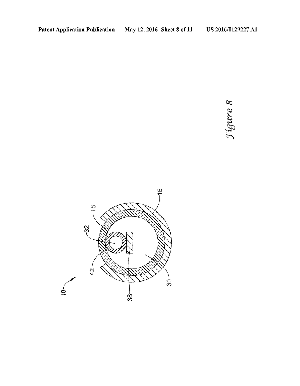 BALLOON CATHETER WITH IMPROVED PUSHABILITY - diagram, schematic, and image 09