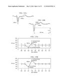 NEUROSTIMULATION TITRATION UTILIZING T-WAVE ALTERNANS diagram and image