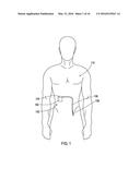 MEDICAL DEVICES HAVING DEFORMABLE STRUCTURES PROVIDING MEDICAL LEAD     FIXATION diagram and image