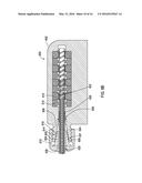 MEDICAL DEVICES HAVING DEFORMABLE STRUCTURES PROVIDING MEDICAL LEAD     FIXATION diagram and image