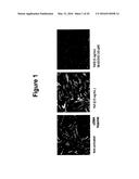 SMALL MOLECULE INHIBITORS OF FIBROSIS diagram and image