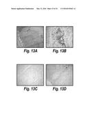 ANTIBODIES AGAINST CD38 FOR TREATMENT OF MULTIPLE MYELOMA diagram and image