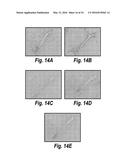 ANTIBODIES AGAINST CD38 FOR TREATMENT OF MULTIPLE MYELOMA diagram and image