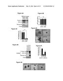 Methods and compositions for prognosis, diagnosis, and treatment of     ADAM8-expressing cancer diagram and image