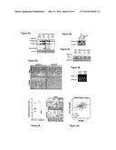 Methods and compositions for prognosis, diagnosis, and treatment of     ADAM8-expressing cancer diagram and image