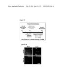 Methods and compositions for prognosis, diagnosis, and treatment of     ADAM8-expressing cancer diagram and image