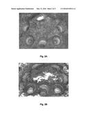 USE OF NITROGEN COMPOUNDS QUATERNISED WITH ALKYLENE OXIDE AND     HYDROCARBYL-SUBSTITUTED POLYCARBOXYLIC ACID AS ADDITIVES IN FUELS AND     LUBRICANTS diagram and image