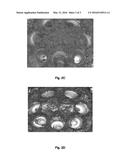 USE OF NITROGEN COMPOUNDS QUATERNISED WITH ALKYLENE OXIDE AND     HYDROCARBYL-SUBSTITUTED POLYCARBOXYLIC ACID AS ADDITIVES IN FUELS AND     LUBRICANTS diagram and image