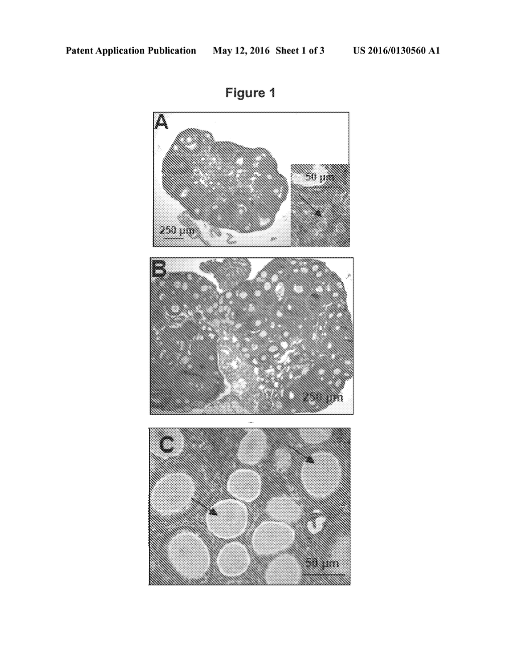 METHODS FOR IN VITRO MATURATION OF OVARIAN FOLLICLES - diagram, schematic, and image 02