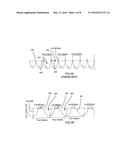 DECOUPLER CLUTCH ENGAGEMENT SURFACE WITH SELECTED SURFACE FINISH diagram and image