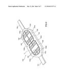 NON-RETURN VALVE FOR A TUBULAR CONSOLIDATION ELEMENT diagram and image