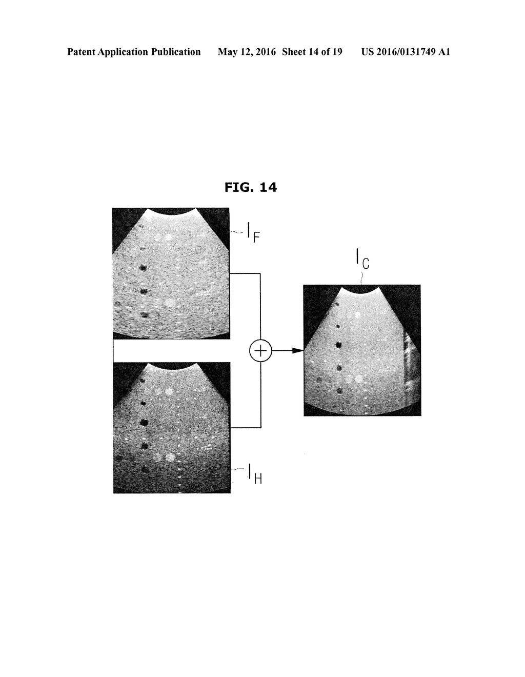 ULTRASONIC DIAGNOSTIC APPARATUS AND METHOD OF CONTROLLING THE SAME - diagram, schematic, and image 15