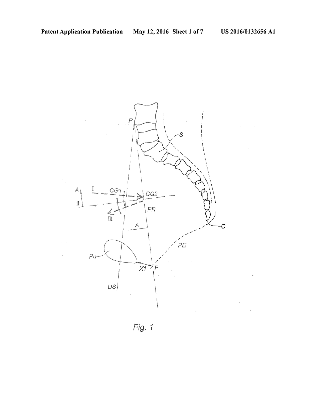 PROCEDURE FOR THE MODELLING OF THE DIRECTION OF INCIDENT ABDOMINAL     PRESSURES TOWARDS THE FEMALE PELVIC CAVITY AND THE DIRECTION OF THE     REFLECTED PRESSURE IN THE PELVIC SPACE - diagram, schematic, and image 02