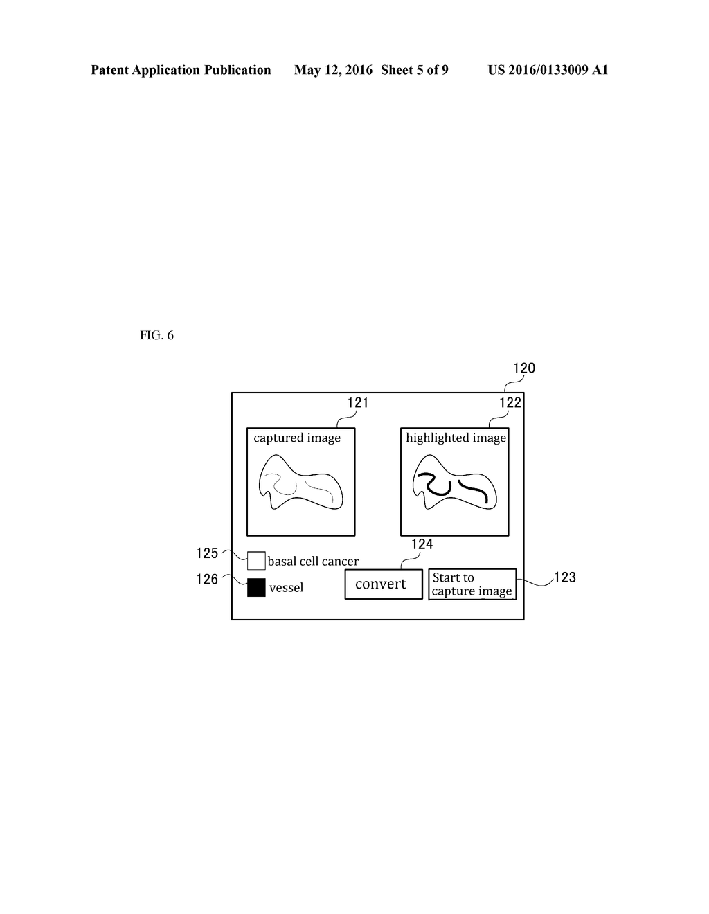 DISEASE DIAGNOSTIC APPARATUS, IMAGE PROCESSING METHOD IN THE SAME     APPARATUS, AND MEDIUM STORING PROGRAM ASSOCIATED WITH THE SAME METHOD - diagram, schematic, and image 06