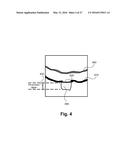 Robust segmentation of retinal pigment epithelium layer diagram and image