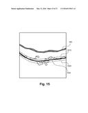 Robust segmentation of retinal pigment epithelium layer diagram and image