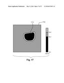 Robust segmentation of retinal pigment epithelium layer diagram and image