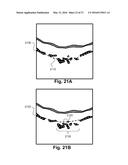 Robust segmentation of retinal pigment epithelium layer diagram and image