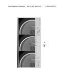 RADIATION CT APPARATUS diagram and image