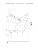 PORTABLE CAMERA AIDED SIMULATOR (PortCAS) FOR MINIMALLY INVASIVE SURGICAL     TRAINING diagram and image