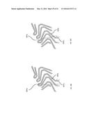 NON-PLANAR INDUCTIVE ELECTRICAL ELEMENTS IN SEMICONDUCTOR PACKAGE LEAD     FRAME diagram and image