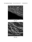 Block-Type Supercapacitors and Fabricating Method for the Same, Graphene     Oxide-Metal Oxide Composite and Synthesizing Method for the Composite diagram and image