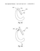 EARPIECE ATTACHMENT DEVICES diagram and image