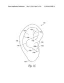 SOUND TRANSMISSION SYSTEMS AND DEVICES HAVING EARPIECES diagram and image