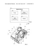 Medical Device diagram and image