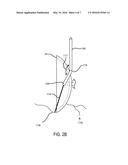 FERTILIZER INJECTOR diagram and image