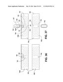 Athletic Band with Removable Module diagram and image