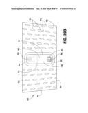 Athletic Band with Removable Module diagram and image