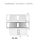 Athletic Band with Removable Module diagram and image