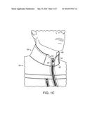 GOLF JACKET HAVING WEATHER-PROTECTIVE COLLAR diagram and image