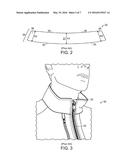 GOLF JACKET HAVING WEATHER-PROTECTIVE COLLAR diagram and image