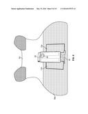 Tourniquet Holster diagram and image