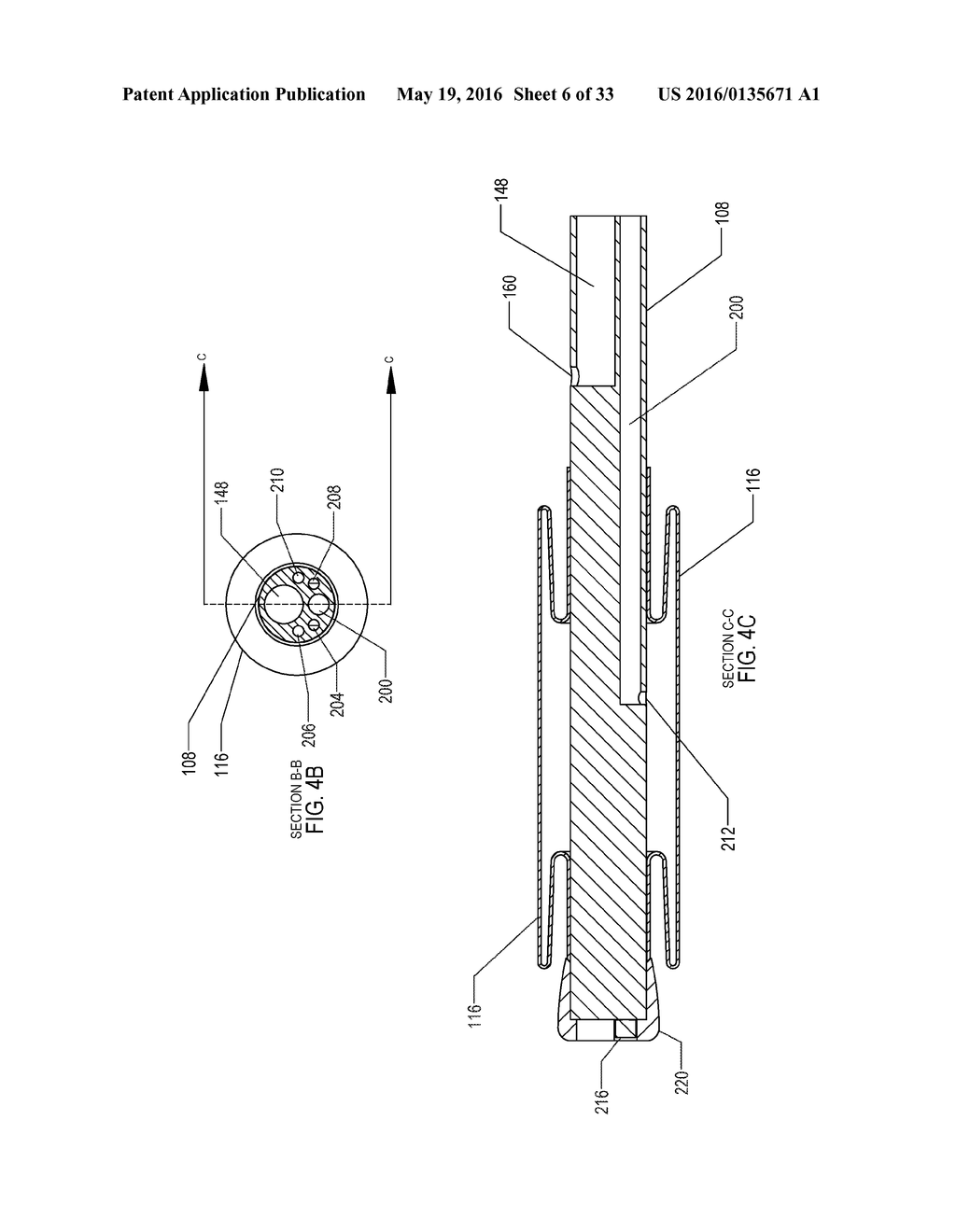 METHOD OF PERFORMING A SPHENOPALATINE GANGLION BLOCK PROCEDURE - diagram, schematic, and image 07