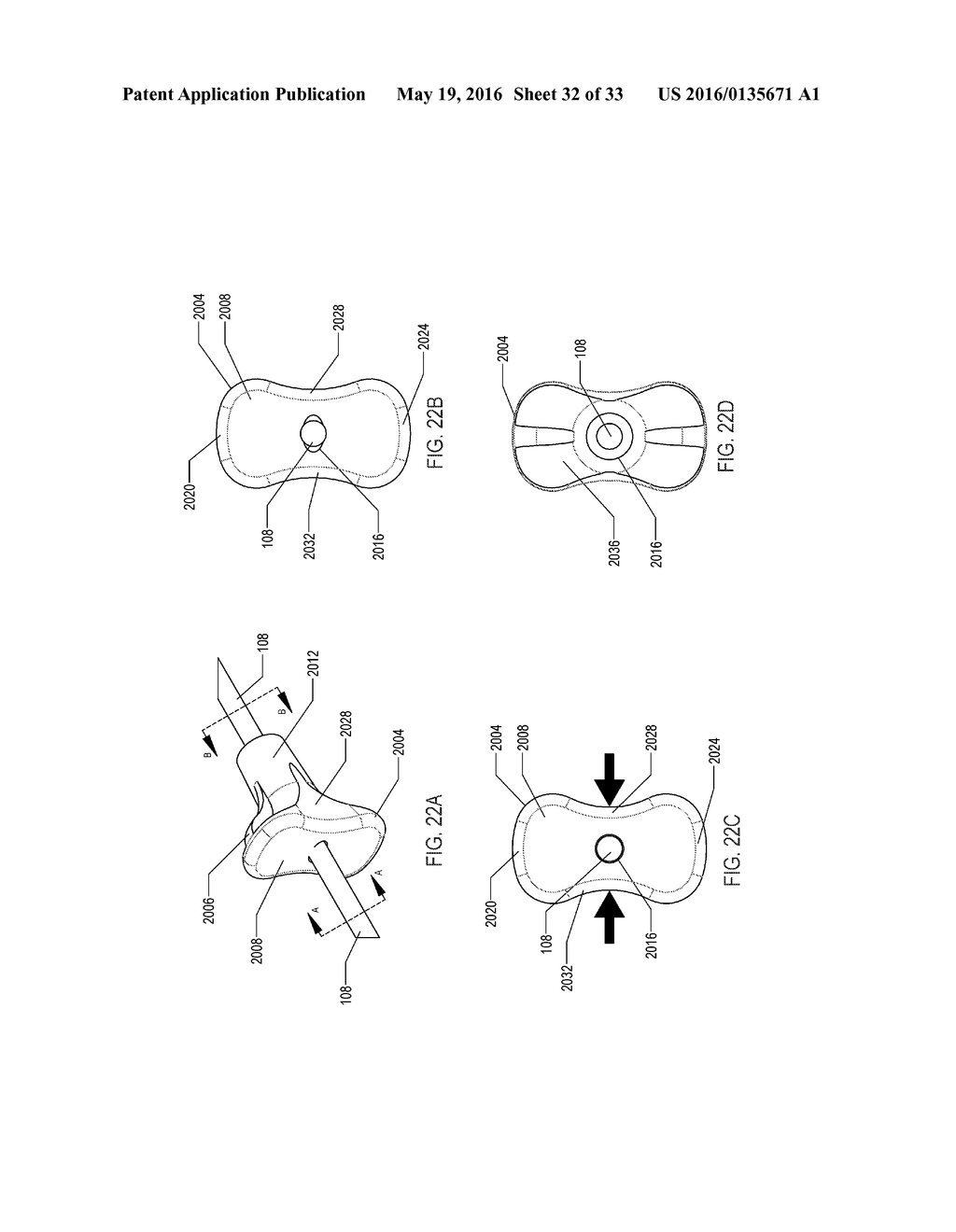 METHOD OF PERFORMING A SPHENOPALATINE GANGLION BLOCK PROCEDURE - diagram, schematic, and image 33