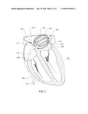 SYSTEMS AND METHODS FOR SELECTING, ACTIVATING, OR SELECTING AND ACTIVATING     TRANSDUCERS diagram and image