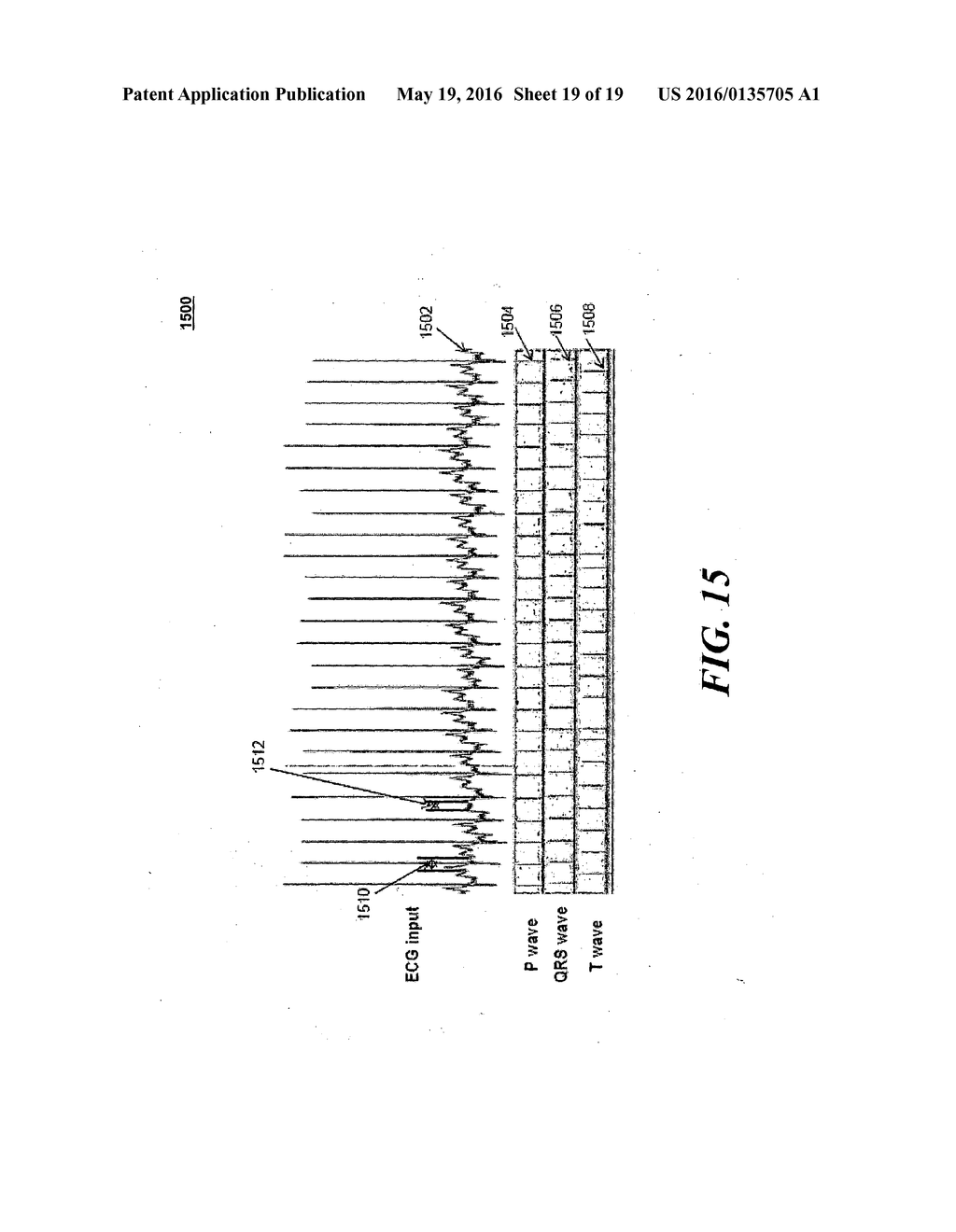 REAL-TIME MULTI-FUNCTIONAL ECG SIGNAL PROCESSING SYSTEM, DSPE FOR THE ECG     SIGNAL PROCESSING SYSTEM, AND METHOD THEREOF - diagram, schematic, and image 20