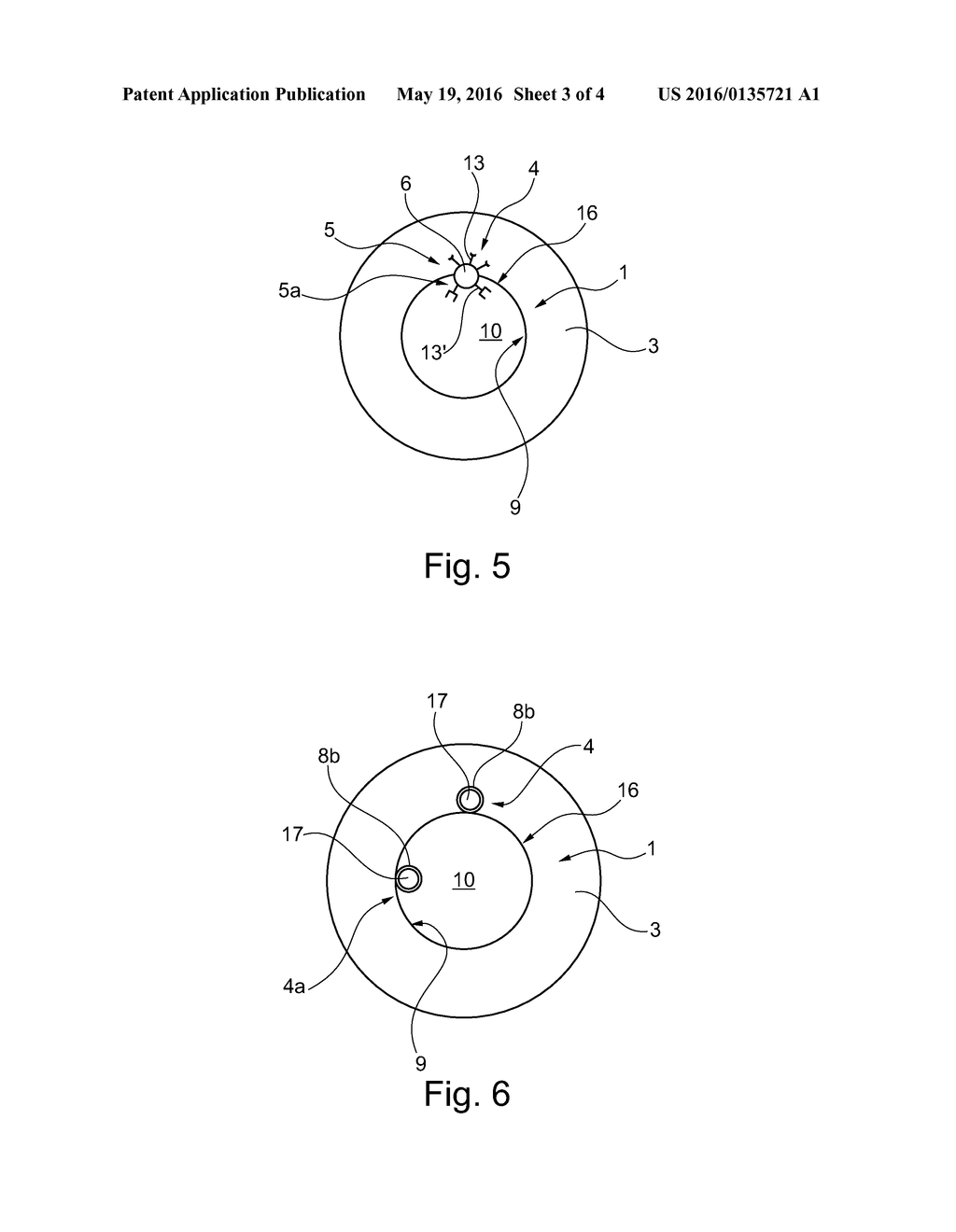 Catheter Comprising a Detection Device for Supplying Real-Time Detection     of a Sample Material - diagram, schematic, and image 04