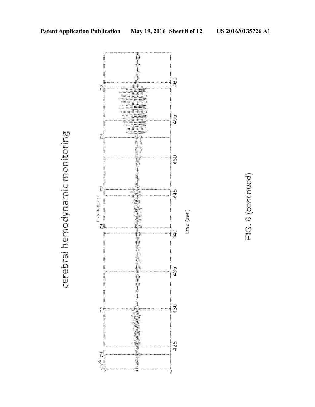 SYSTEM AND METHOD FOR NON-INVASIVE, INTRACRANIAL B RAIN MOTION MONITORING - diagram, schematic, and image 09