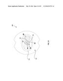 WIRELESS PRESSURE ULCER ALERT METHODS AND SYSTEMS THEREFOR diagram and image